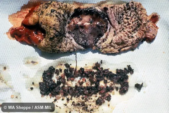 Interior of stomach, removed from specimen, showing pyloric and cardiac regions and stomach contents including small pebbles.  Formerly as Manis temminckii.  Also as Temminck's Pangolin, Cape Pangolin.